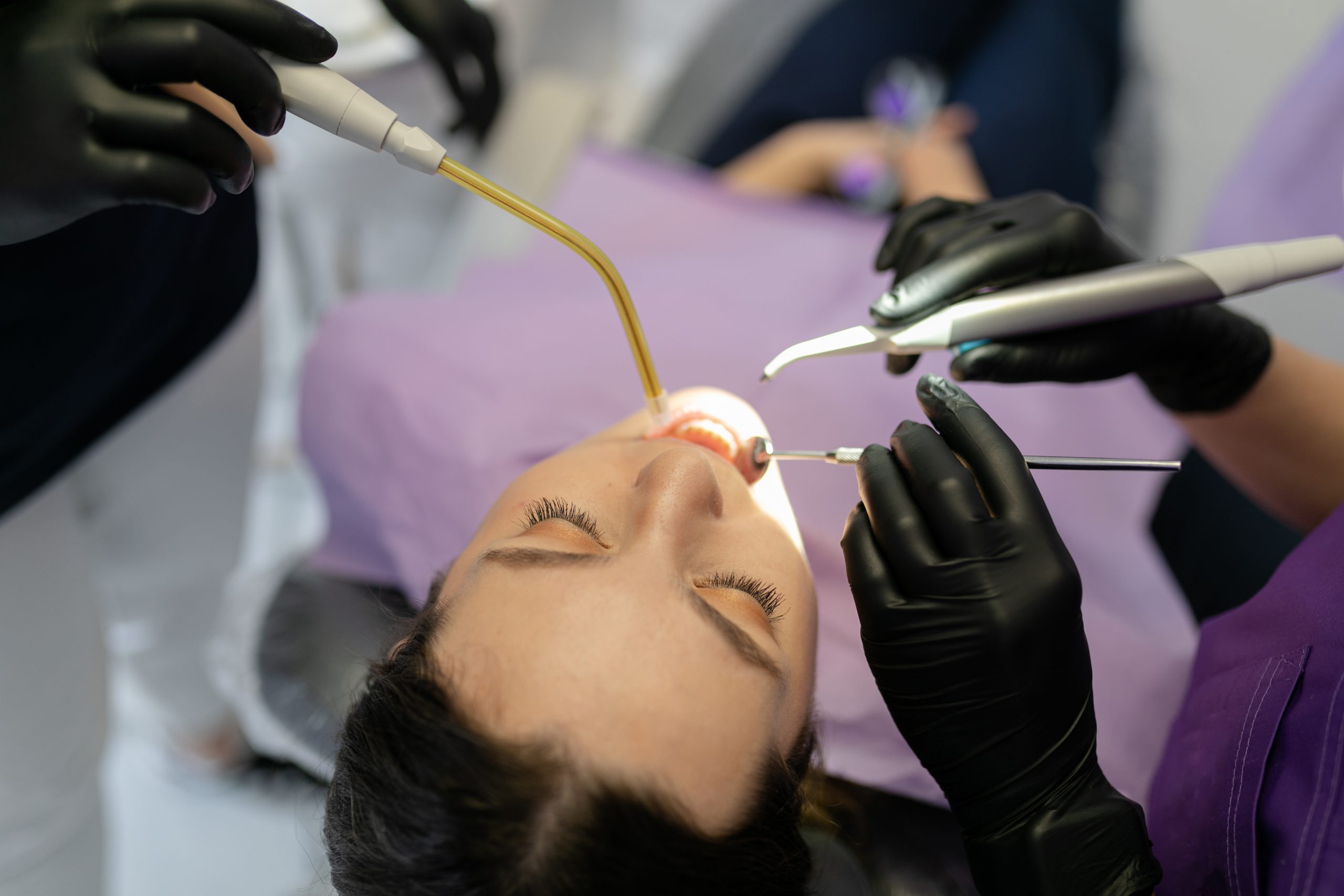 igienizare dentară profesională