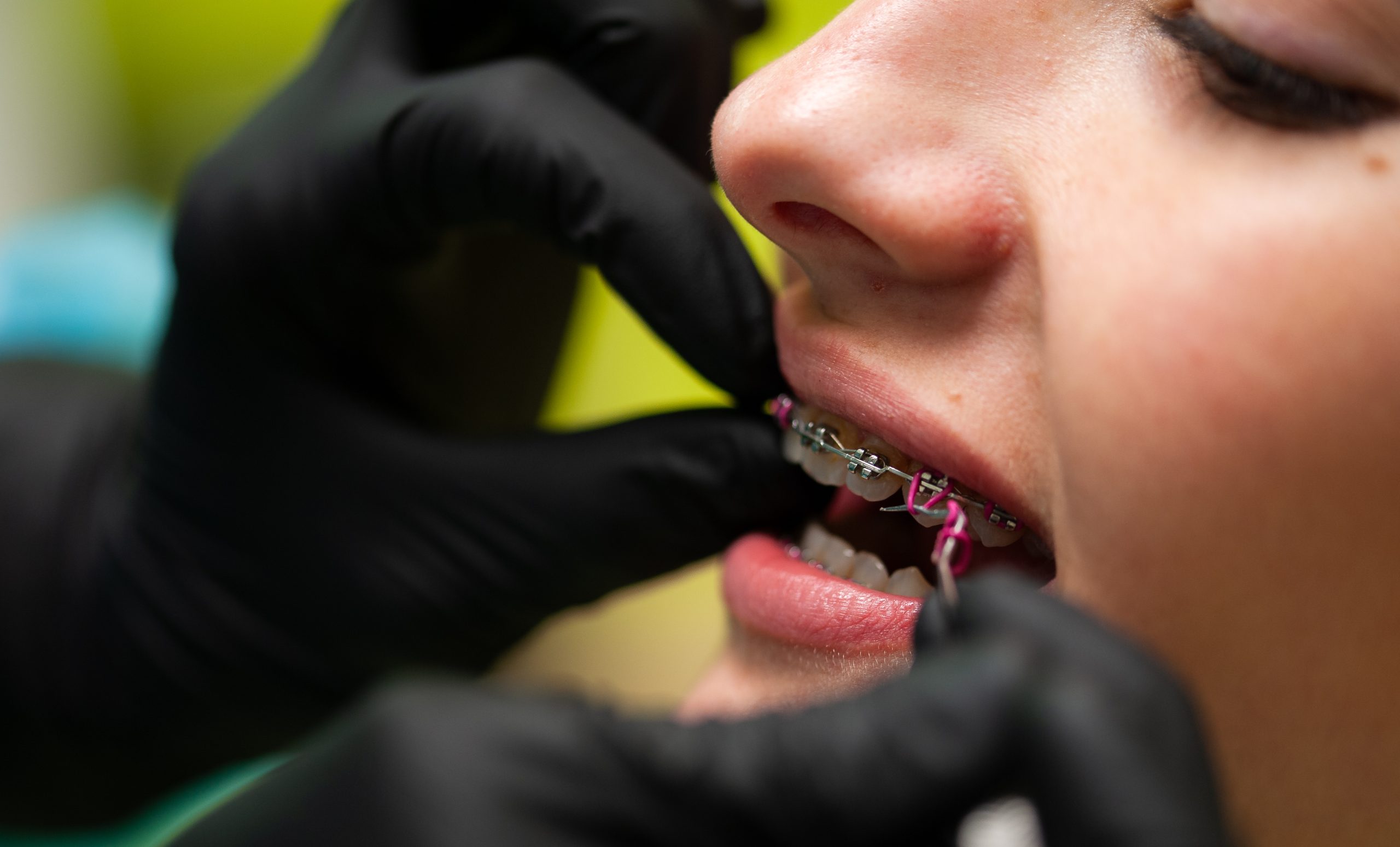 copil sau adult cu aparat dentar