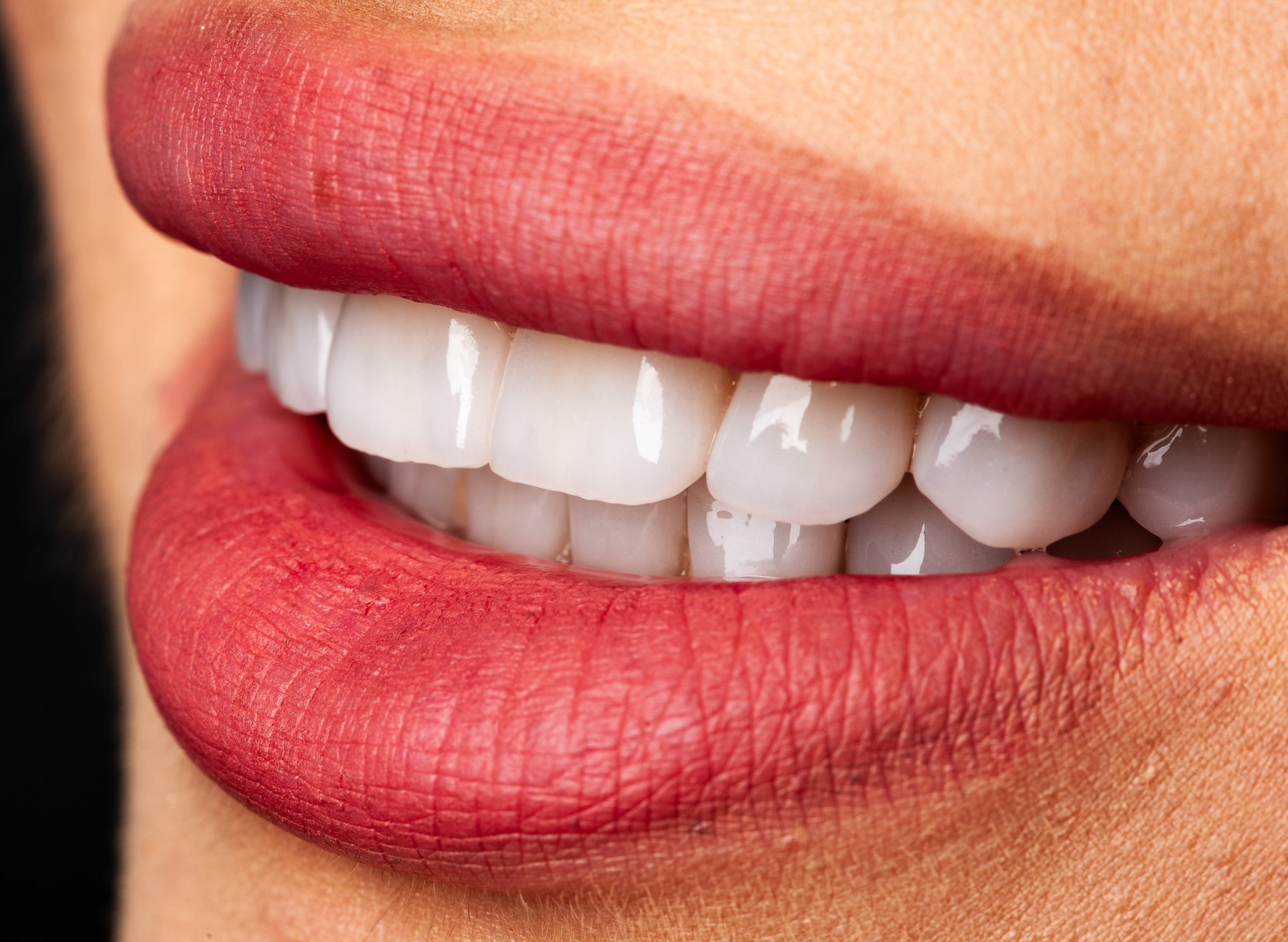 zâmbet complet restaurat